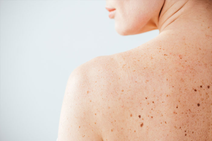 dermatologos-kirimlidou|photo