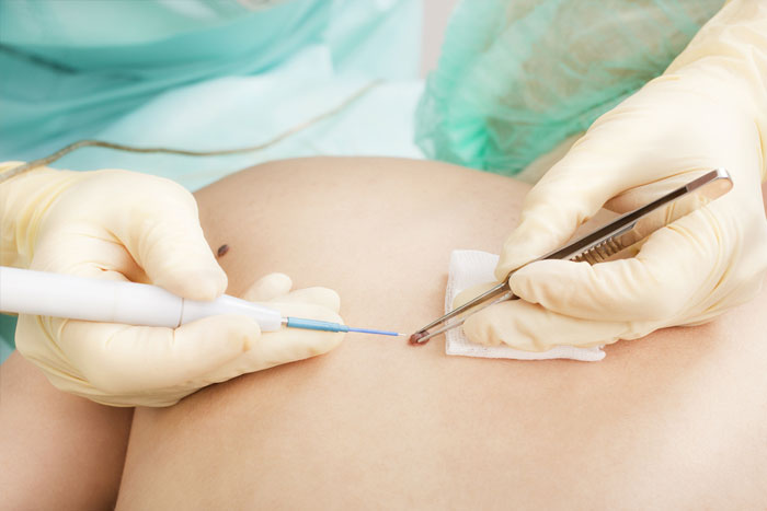 dermatologos-kirimlidou|photo