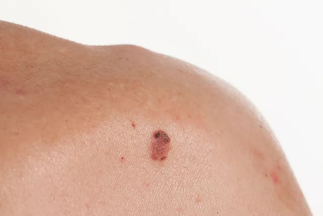 dermatologos-kirimlidou|photo