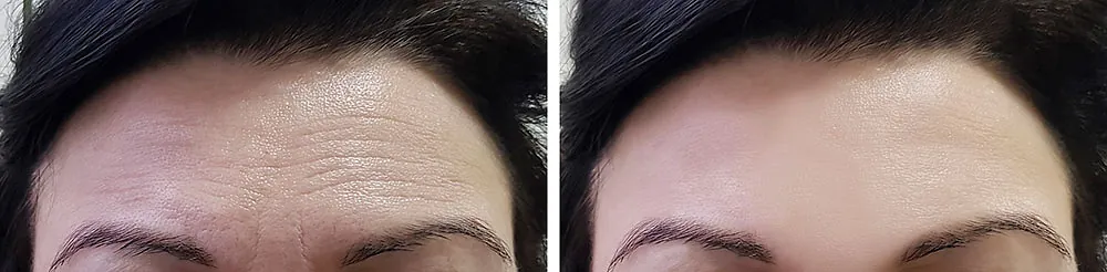 dermatologos-kirimlidou|photo