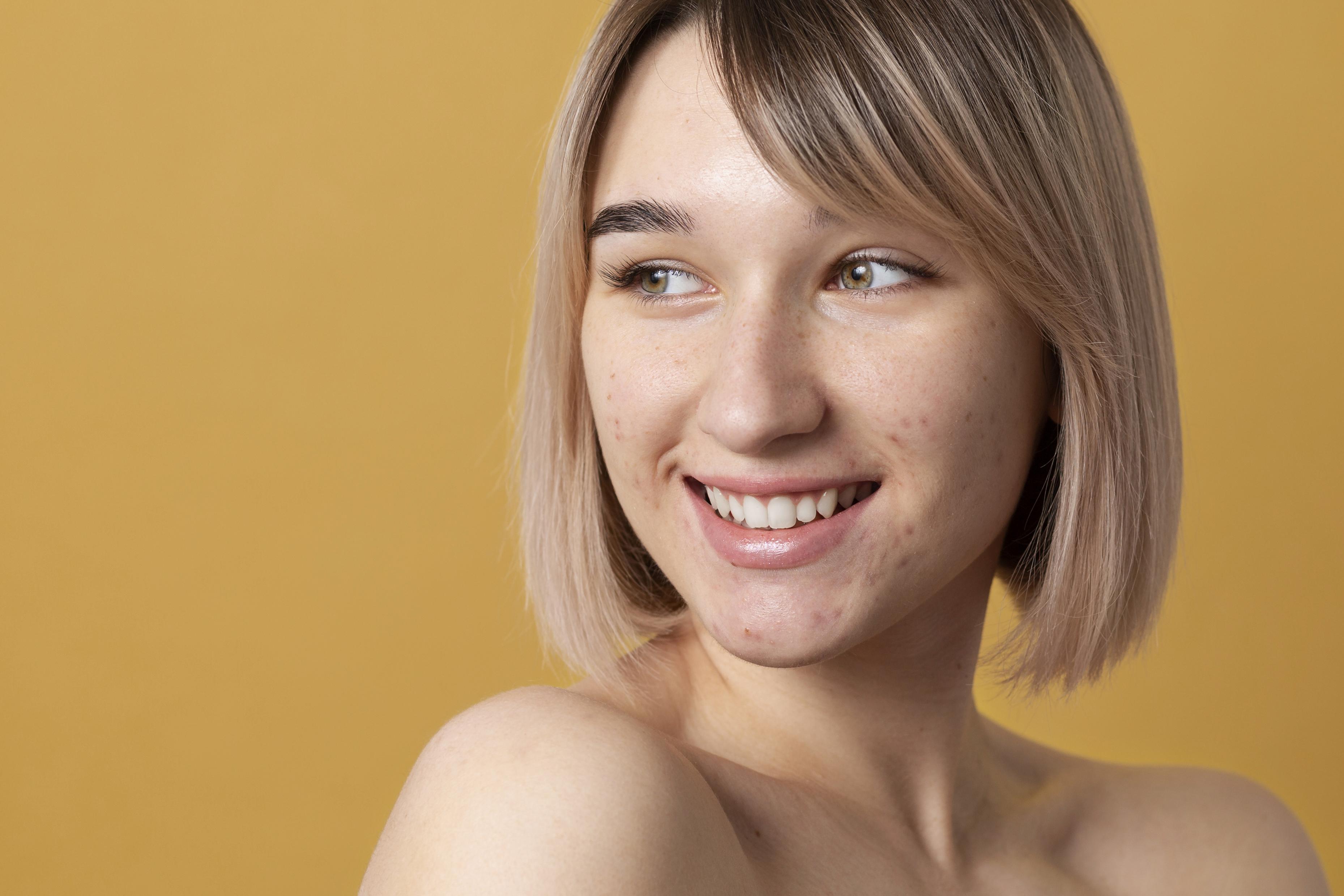 Πλάνο χαμογελαστής γυναίκας με ακμή