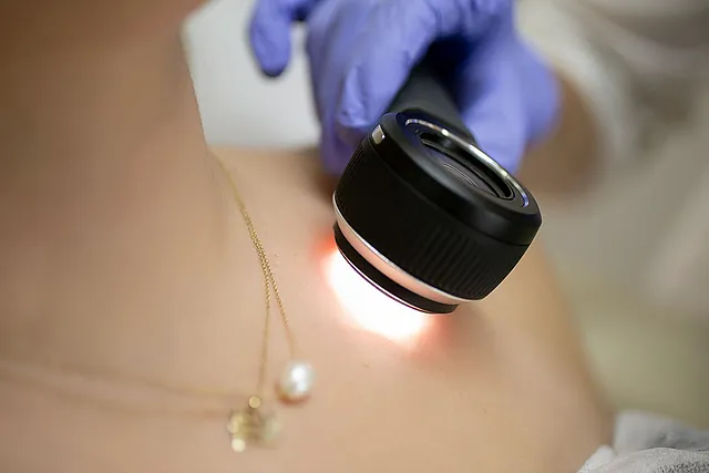 dermatologos-kirimlidou|photo